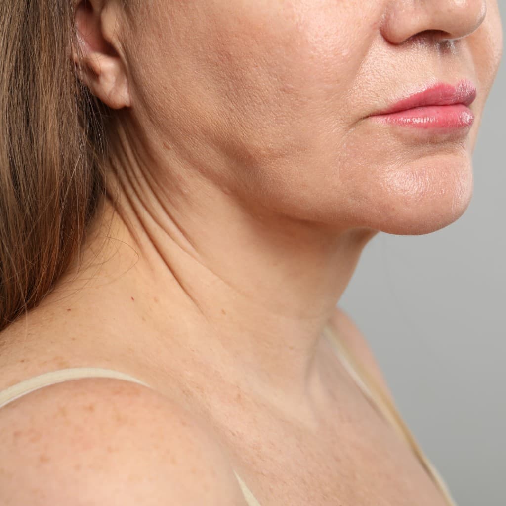 Side profile highlighting jawline and neck as areas for gentle face yoga and daily care